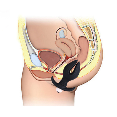 Silicone Anale Speciale Anale Stop met Trillende Kogels