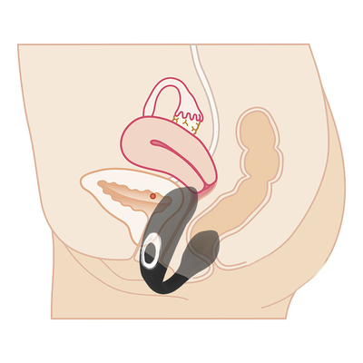 Waterdicht oplaadbaar G-spot vibrator Anal clitoris vibrator voor vrouwen FOB Referentieprijs:Krijg de laatste prijs