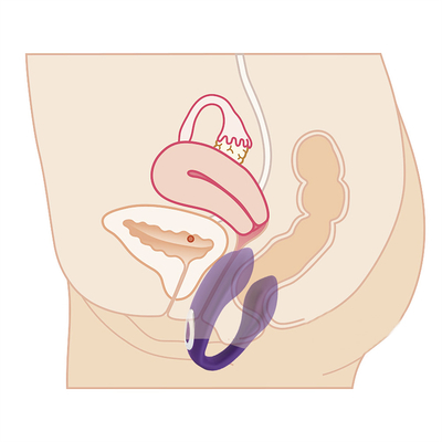 Waterdicht oplaadbaar G-spot vibrator Anal clitoris vibrator voor vrouwen FOB Referentieprijs:Krijg de laatste prijs