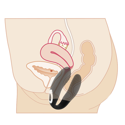 Afstandsbediening Vagina massage vibrator Onzichtbare clitoris vibrator