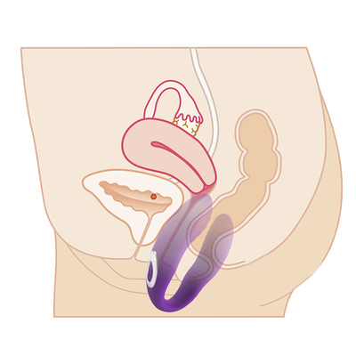 Afstandsbediening Vagina massage vibrator Onzichtbare clitoris vibrator